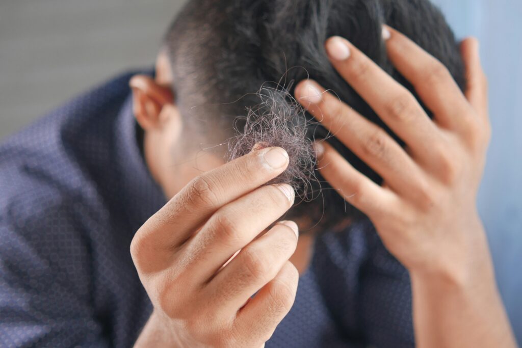 hombre agarrando un mechon caido de cabello
